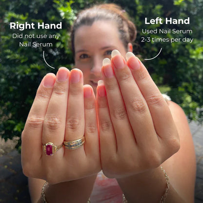 Zalia Nail Rescue Pen – Natural Nail Growth & Cuticle Oil