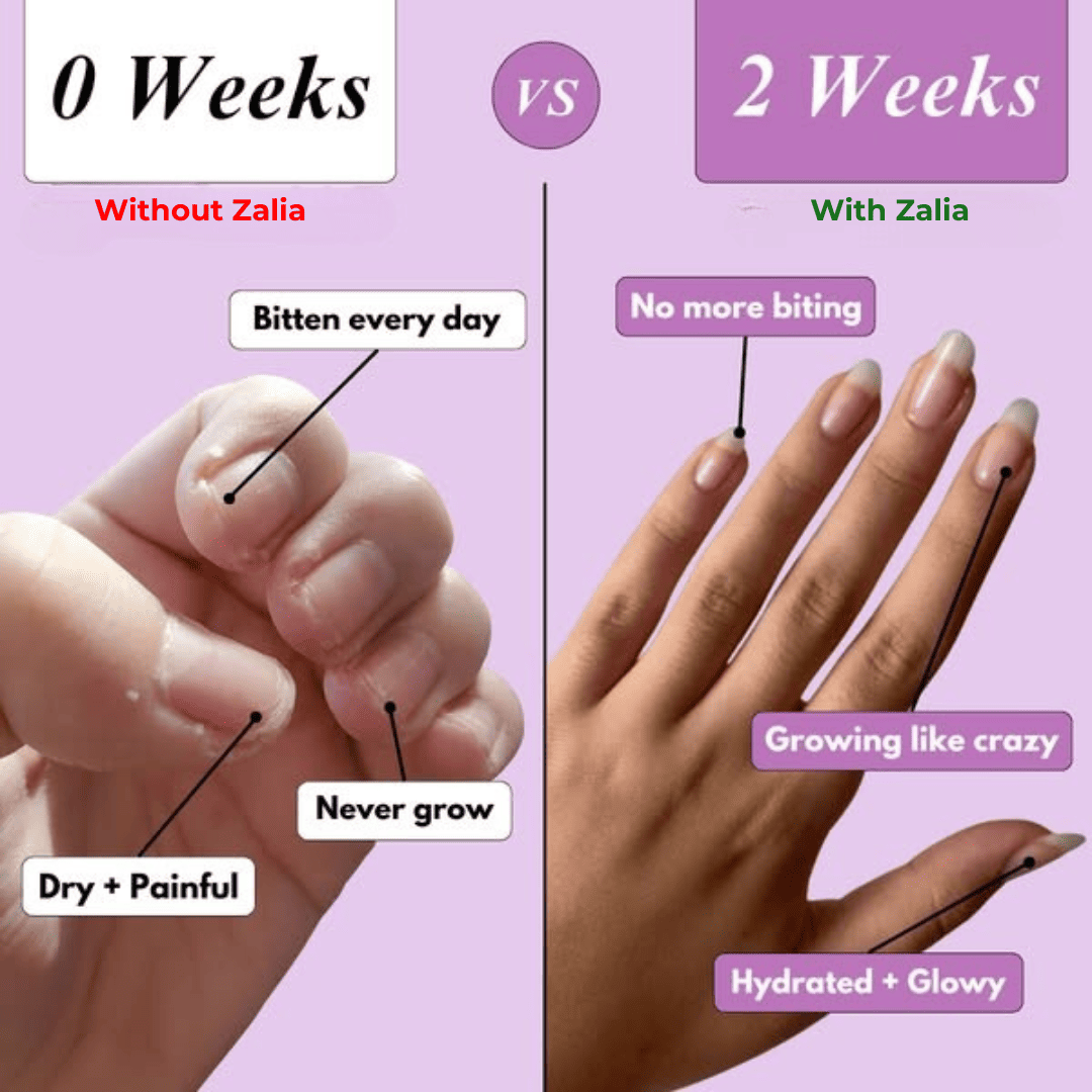 Zalia Nail Rescue Pen – Natural Nail Growth & Cuticle Oil