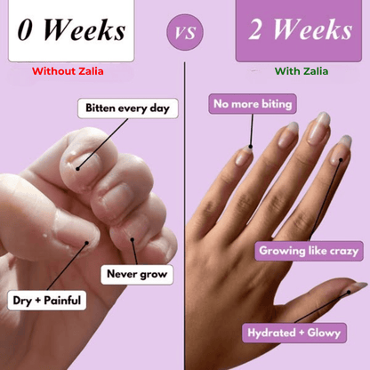 Zalia Nail Rescue Pen – Natural Nail Growth & Cuticle Oil